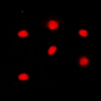 RB1 (Phospho-S795) Rabbit Polyclonal Antibody
