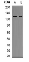 RB1 (Phospho-S807) Rabbit Polyclonal Antibody
