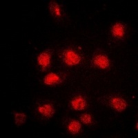 RB1 (Phospho-S807) Rabbit Polyclonal Antibody