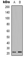 BID Rabbit Polyclonal Antibody