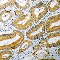 BID Rabbit Polyclonal Antibody