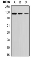PERK Rabbit Polyclonal Antibody