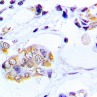 PERK Rabbit Polyclonal Antibody