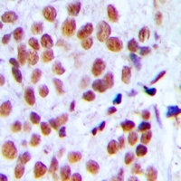 hnRNP L Rabbit Polyclonal Antibody