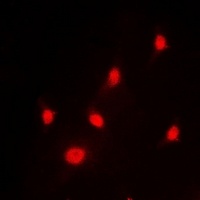 hnRNP L Rabbit Polyclonal Antibody