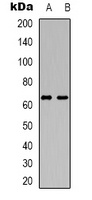 DCP1A Rabbit Polyclonal Antibody
