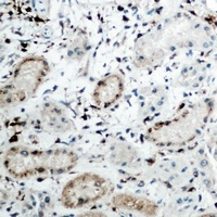 DCP1A Rabbit Polyclonal Antibody