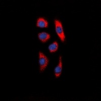 DCP1A Rabbit Polyclonal Antibody