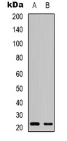 MGMT Rabbit Polyclonal Antibody