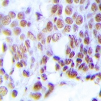 MGMT Rabbit Polyclonal Antibody