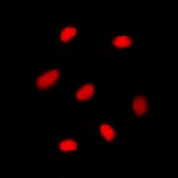 MGMT Rabbit Polyclonal Antibody