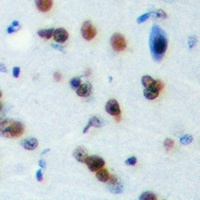 PLEKHG4 Rabbit Polyclonal Antibody