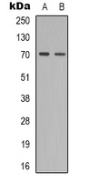 ZAP70 (Phospho-Y319) Rabbit Polyclonal Antibody
