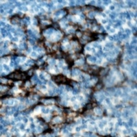 ZAP70 (Phospho-Y319) Rabbit Polyclonal Antibody