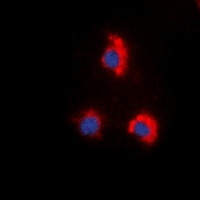 ZAP70 (Phospho-Y319) Rabbit Polyclonal Antibody