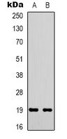 STMN1 (Phospho-S38) Rabbit Polyclonal Antibody