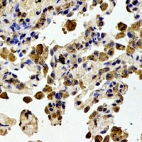 STMN1 (Phospho-S38) Rabbit Polyclonal Antibody