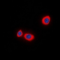 STMN1 (Phospho-S38) Rabbit Polyclonal Antibody