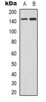 c-Met Rabbit Polyclonal Antibody