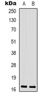 CPI17 (Phospho-T38) Rabbit Polyclonal Antibody