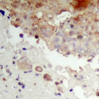 IKB epsilon (Phospho-S22) Rabbit Polyclonal Antibody