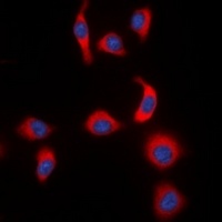 IKB epsilon (Phospho-S22) Rabbit Polyclonal Antibody