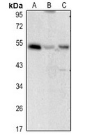 CD122 Rabbit Polyclonal Antibody