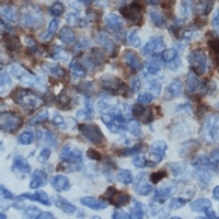 CD122 Rabbit Polyclonal Antibody