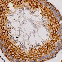Adenosine A2a Receptor Rabbit Polyclonal Antibody