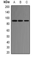 ACE2 Rabbit Polyclonal Antibody