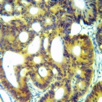 ACE2 Rabbit Polyclonal Antibody