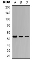 p53 (Phospho-S46) Rabbit Polyclonal Antibody