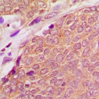 ASC Rabbit Polyclonal Antibody