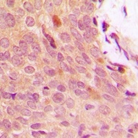 IKB alpha (Phospho-Y42) Rabbit Polyclonal Antibody