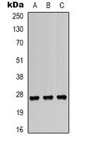 HSP27 (Phospho-S82) Rabbit Polyclonal Antibody