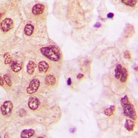 HSP27 (Phospho-S82) Rabbit Polyclonal Antibody