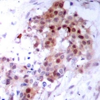 p38 Rabbit Polyclonal Antibody