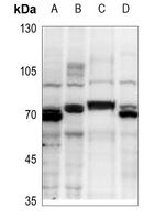 TRAF6 Rabbit Polyclonal Antibody