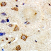 TRAF6 Rabbit Polyclonal Antibody