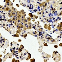 BCL2 (Phospho-T56) Rabbit Polyclonal Antibody