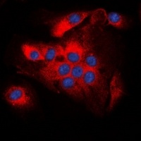 BCL2 (Phospho-T56) Rabbit Polyclonal Antibody