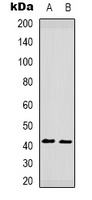 CCR5 (Phospho-S349) Rabbit Polyclonal Antibody