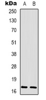 Histone H3 (Phospho-T3) Rabbit Polyclonal Antibody
