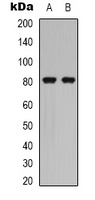 Caldesmon (Phospho-S789) Rabbit Polyclonal Antibody