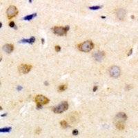 Caldesmon (Phospho-S789) Rabbit Polyclonal Antibody