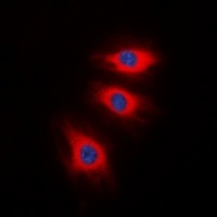 Caldesmon (Phospho-S789) Rabbit Polyclonal Antibody