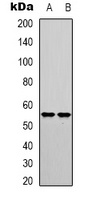 IRF3 (Phospho-S385) Rabbit Polyclonal Antibody