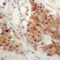 IRF3 (Phospho-S385) Rabbit Polyclonal Antibody