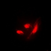 IRF3 (Phospho-S385) Rabbit Polyclonal Antibody