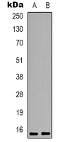 PEA15 (Phospho-S116) Rabbit Polyclonal Antibody